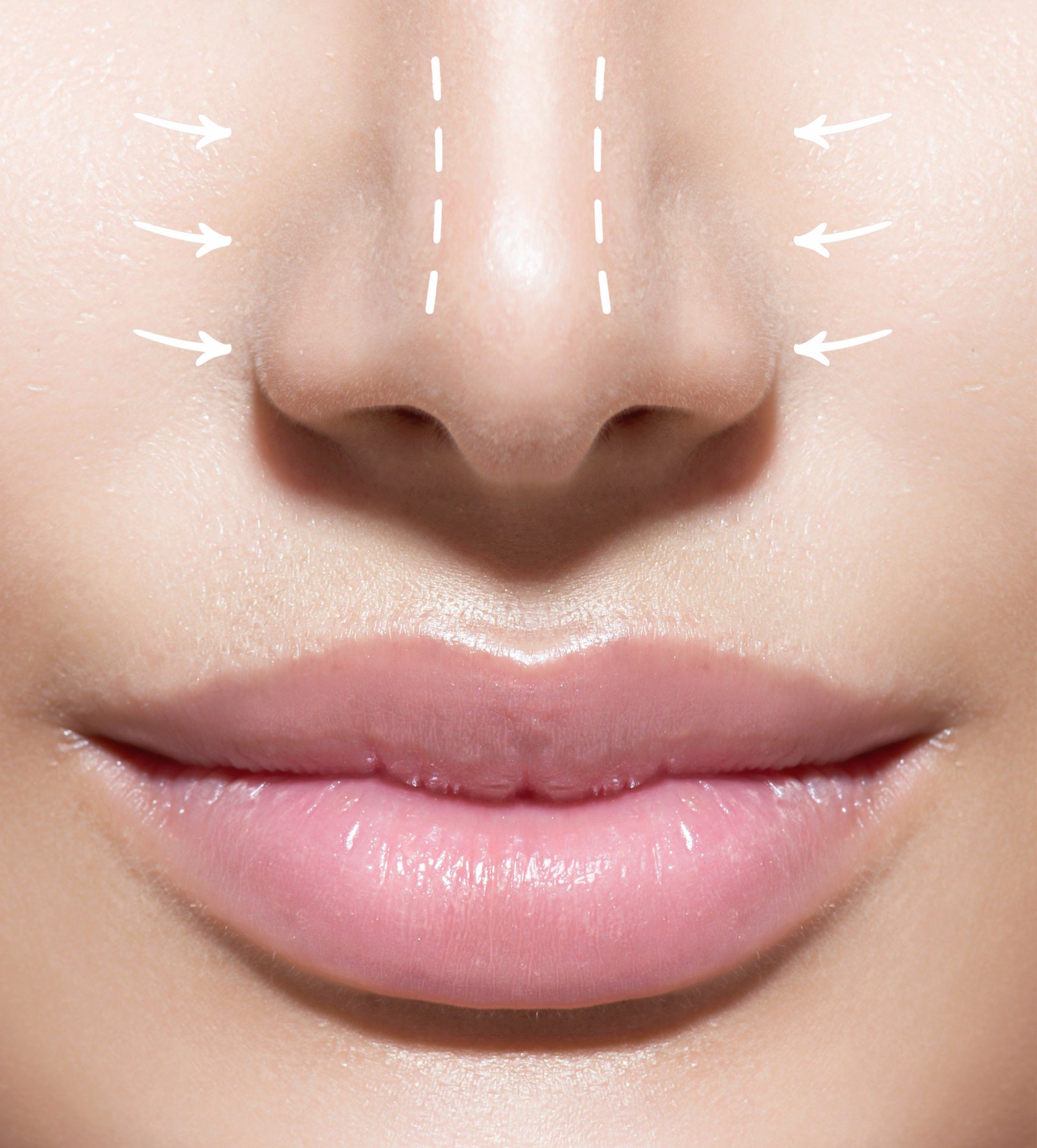 Lips surgery Clínica Neurológica Dr. Carvajal Lizano